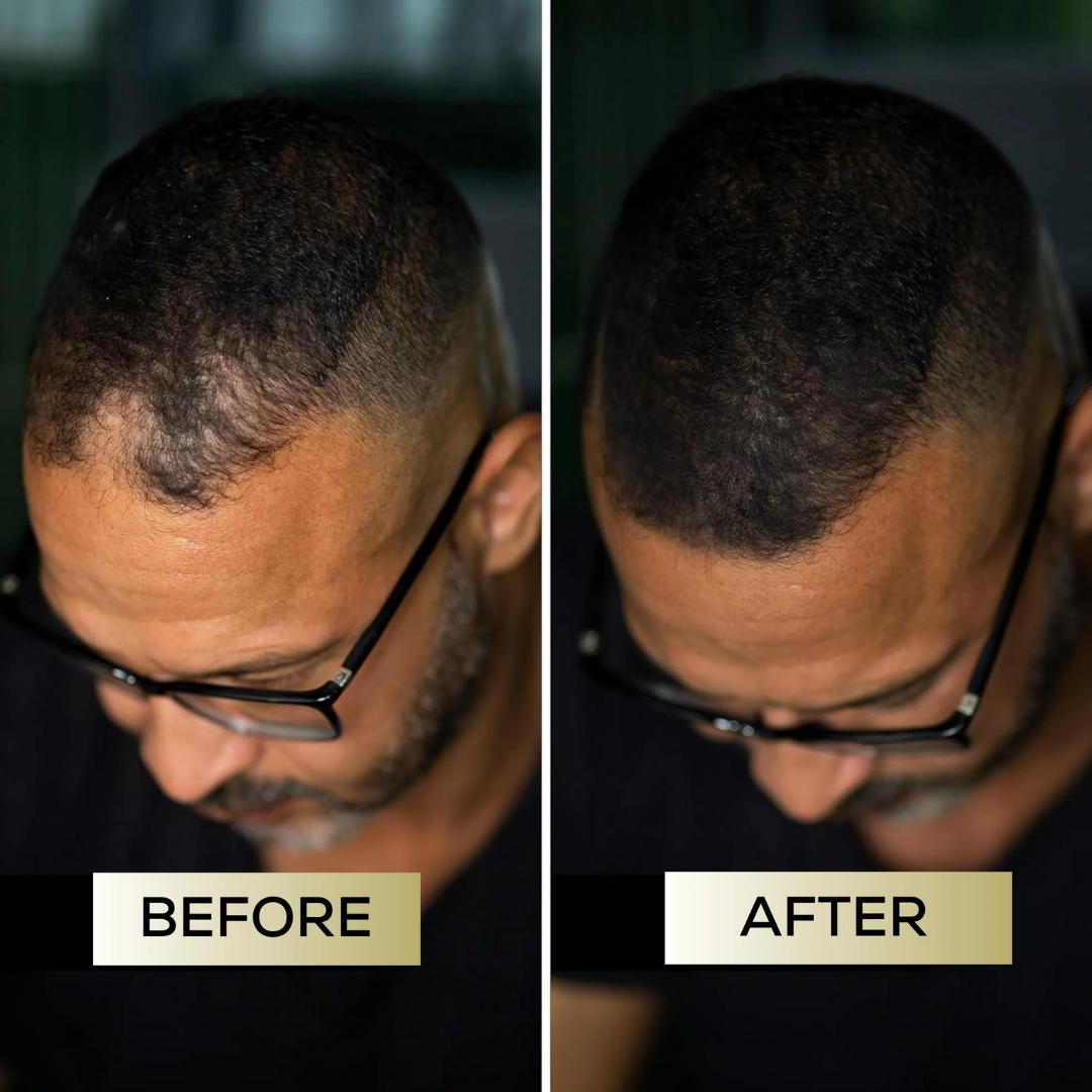 Scalp Concealer for Fuller, Natural-Looking Hair (BUY 1 GET 1 FREE)