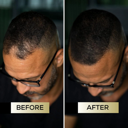 Scalp Concealer for Fuller, Natural-Looking Hair (BUY 1 GET 1 FREE)