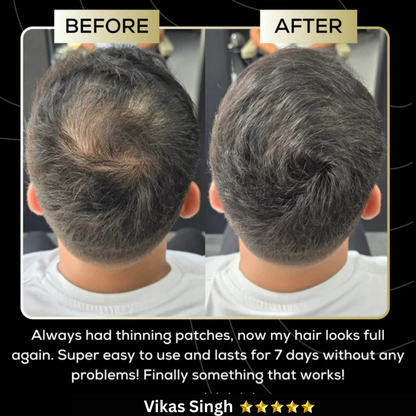 Scalp Concealer for Fuller, Natural-Looking Hair (BUY 1 GET 1 FREE)